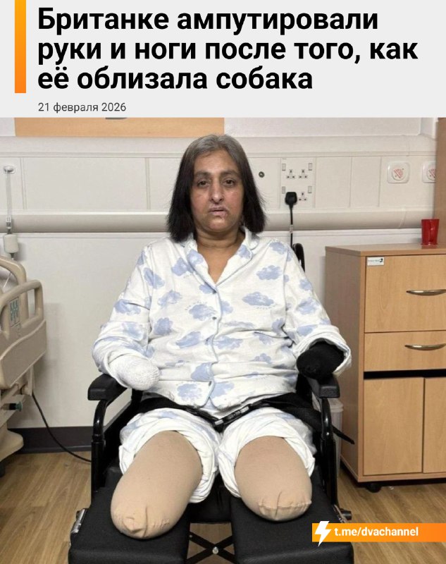 بترت ذراعا وساقا امرأة بريطانية بعد أن لعقها كلب. في يوليو 52…
