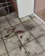 احذروا بالفيديو: رجل قطع عضوه الذكري وانتحر في… احذروا بالفيديو: رجل قطع عضوه الذكري وانتحر في…