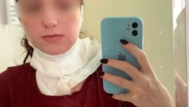 أحد سكان منطقة موسكو انتهى به الأمر في العناية المركزة بعد خلع ضرس العقل… أحد سكان منطقة موسكو انتهى به الأمر في العناية المركزة بعد خلع ضرس العقل…