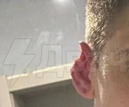 قام زعيم عصابة من المهاجرين بقضم أذن روسي في أحد المقاهي وفقد جنسيته الروسية. بواسطة…