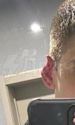 قام زعيم عصابة من المهاجرين بقضم أذن روسي في أحد المقاهي وفقد جنسيته الروسية. بواسطة…