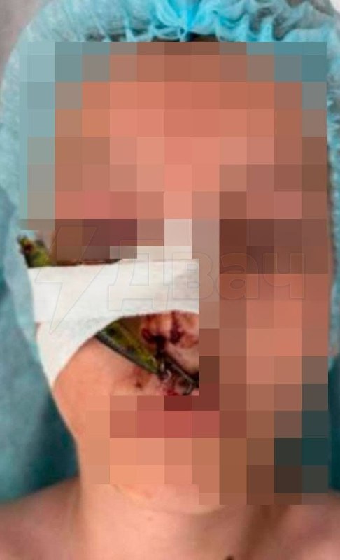 ذهب تلميذ ليصطاد سمك الدنيس، لكنه أمسك بنفسه فقط. في منطقة موسكو، طفل يبلغ من العمر 10 سنوات…