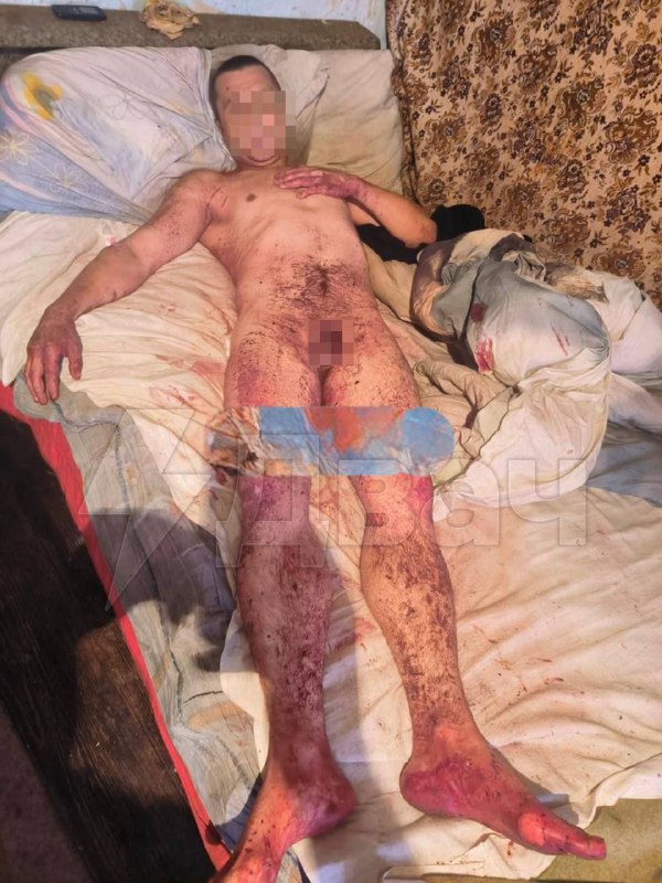 وحشية شرسة في أوكرانيا الصورة ليست لضعاف القلوب: فالكيري عدوانية تقطع…